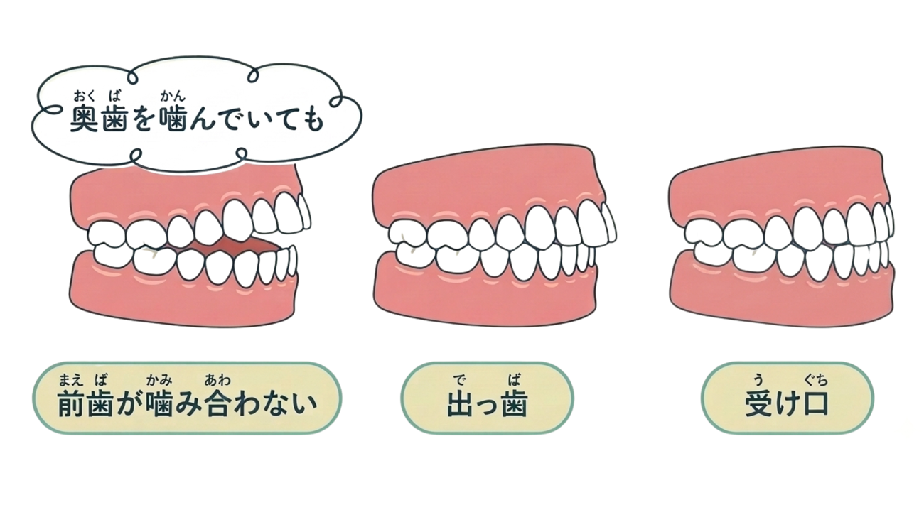 歯並びへの影響