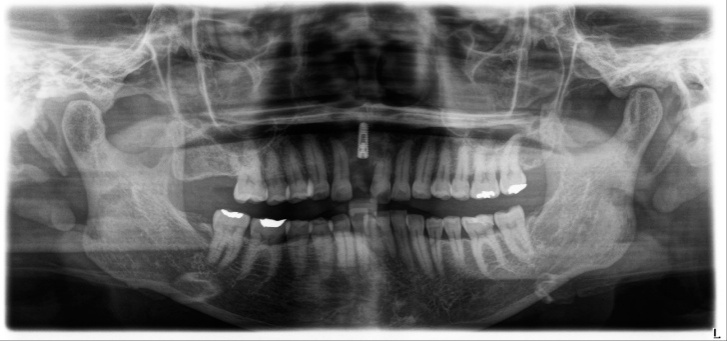 Case1 R7.12