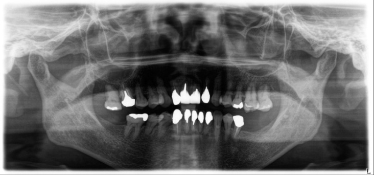 Case2 R7.12