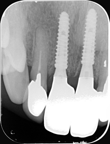 Case2 R8.7