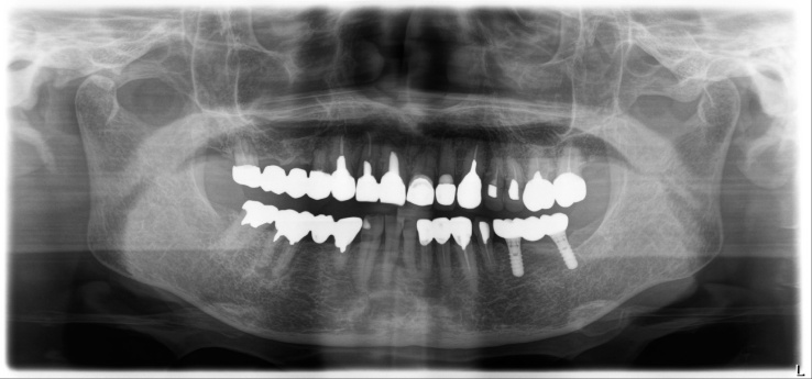 Case4 R7.1